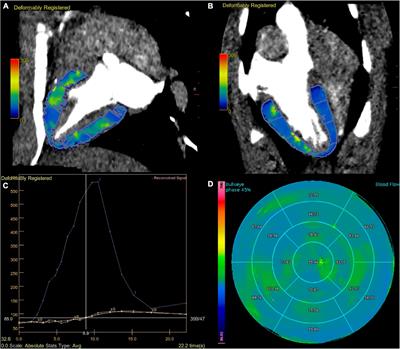 Dose Reduction of Dynamic Computed Tomography Myocardial Perfusion Imaging by Tube Voltage Change: Investigation in a Swine Model